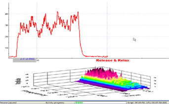 Glazer Intrapelvic sEMG Assessment Suite st EEG Sales