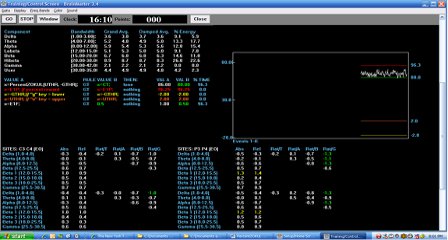 ANI 2Ch Z-ScoreAdd On  for Atlantis 2Ch Z-Score for Atlantis,z-score,2Ch Z-Score,brainmaster atlantis,brainmaster technologies, atlantis,brainmaster,eeg,neurofeedback,neurofeedback software