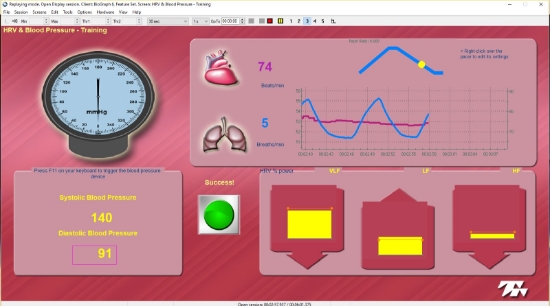 BioGraph 6 software upgrade by Thought Technology at EEG Sales