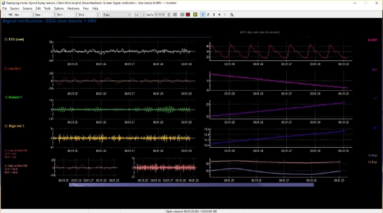 BioGraph 6 software by Thought Technology at EEG Sales