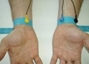 EKG Wrist Strap replacements (2) - ELT-9329