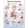 Dangers of Smoking in Spanish (Peligros del tabaquismo) Anatomical Chart